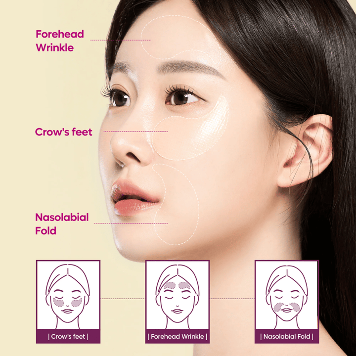 Model with eye patches placed on crow's feet, forehead, and nasolabial lines showing how Dr. Melaxin Cemenrete Calcium Volume Eye Patch can be used for wrinkles and volume loss.