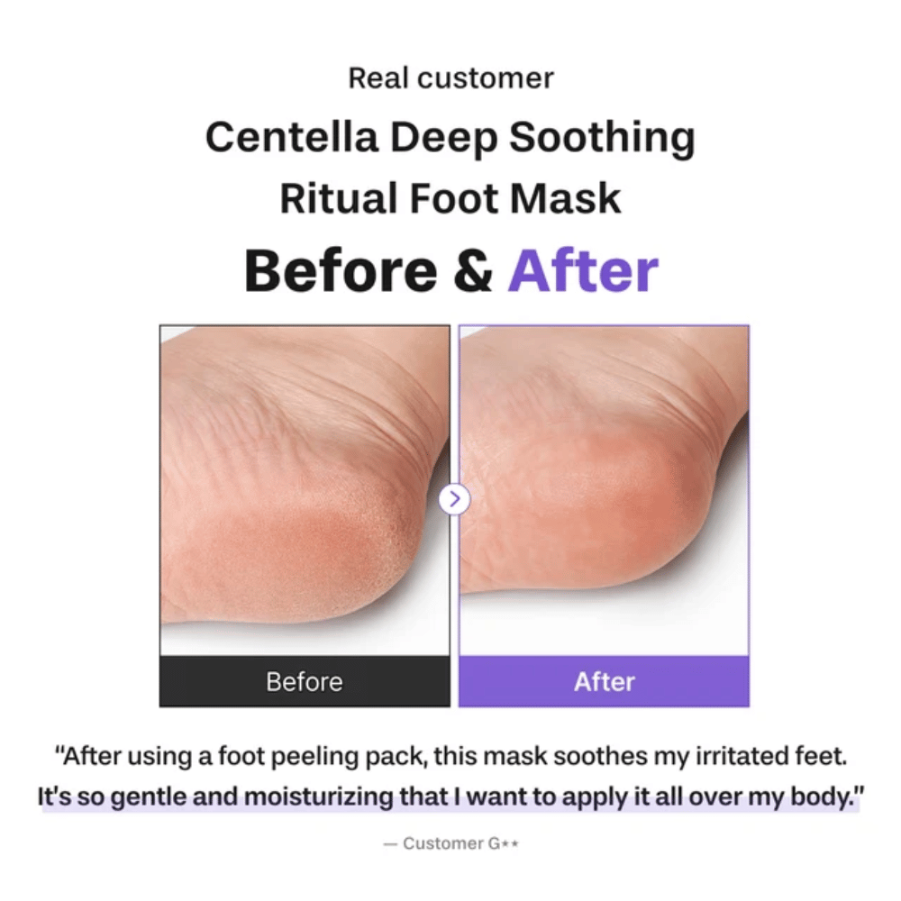 6. Baren Centella Deep Soothing Ritual Foot Mask – before-and-after image showing a softer and more moisturized heel after use