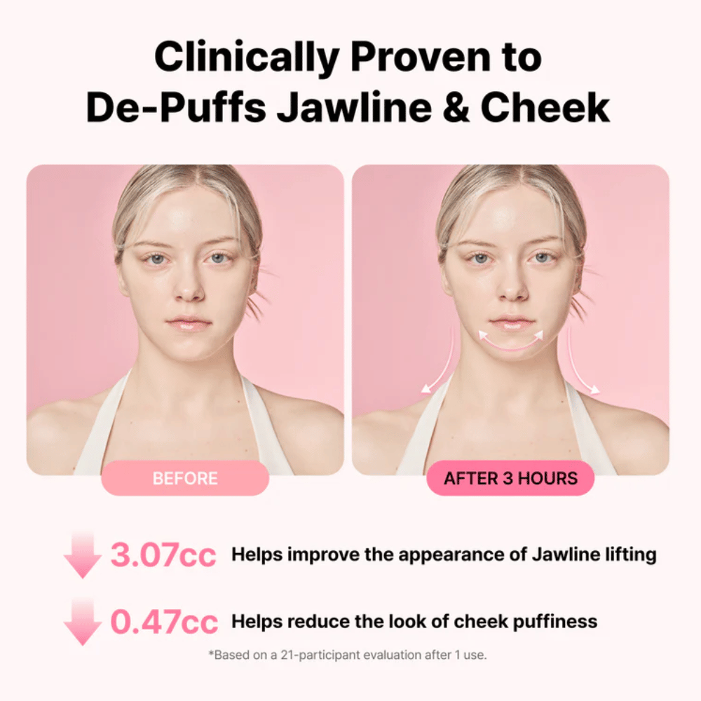 Before-and-after image illustrating improved appearance of the jawline and reduced swelling after using RETURNITY Ear Therapy Acupressure Patch for three hours.