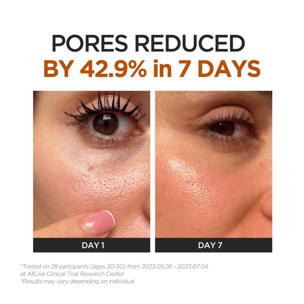 Before-and-after image showing visibly reduced pores after seven days of use. Close-up images of the skin illustrate a more even and smoother skin texture between day 1 and day 7.